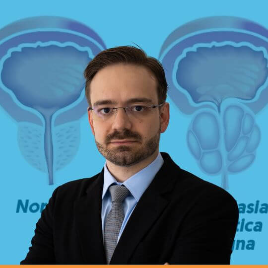 Hiperplasia prostatica Dr Tiago