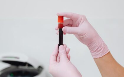 Close-up of gloved hands holding a blood sample in a test tube, ideal for medical and lab contexts.
