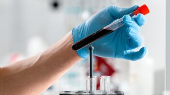 Close-up of a gloved hand holding a test tube with blood sample in a clinical research lab.