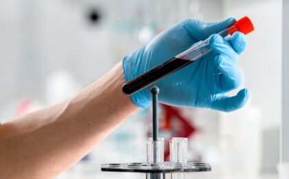 Close-up of a gloved hand holding a test tube with blood sample in a clinical research lab.