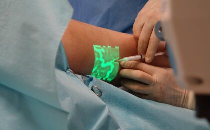 A doctor performs a medical procedure using advanced vein visualization technology.